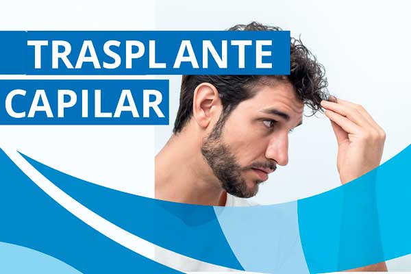 Implante Capilar Sevilla Aurea Clinic