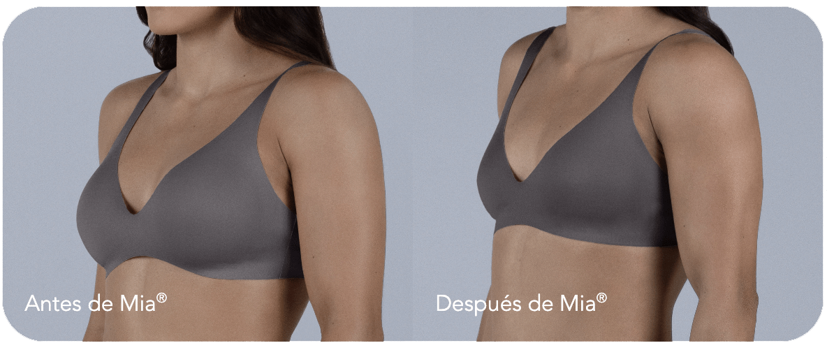 caso mia femtech