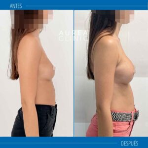 mia femtech antes y después